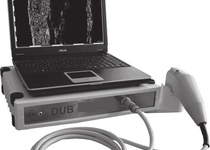 Портативний сканер для кожи DUB Сutis S
