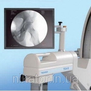 Рентгенодіагностичний хірургічний апарат TCA 6S C