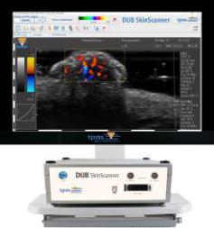 Сканер ультразвуковий DUB Skinscanner 22